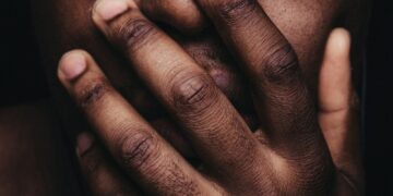 persons hand on his face